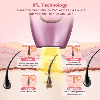 جهاز IPL المنزلي لإزالة الشعر بالليزر - تقنية احترافية آمنة وفعالة للرجال والنساء